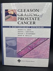 Gleason Grading Of Prostate Cancer